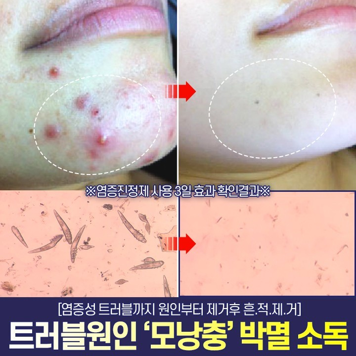 까레넬 히아루 비타5 시카세럼 30ml