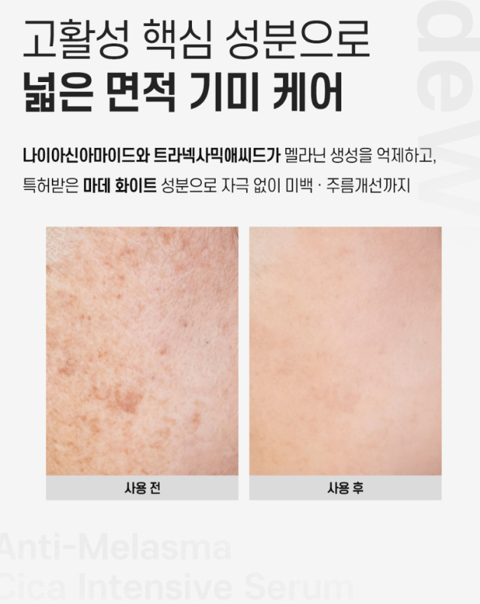 까레넬 기미잡티 안색개선 안티멜라즈마 세럼 30ml