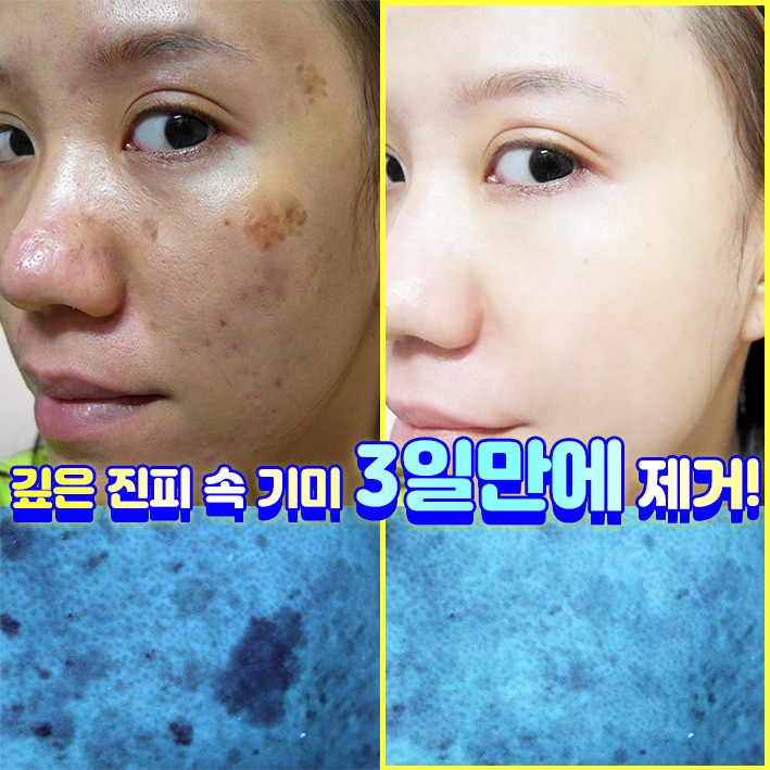 까레넬 기미잡티 안색개선 안티멜라즈마 세럼 30ml