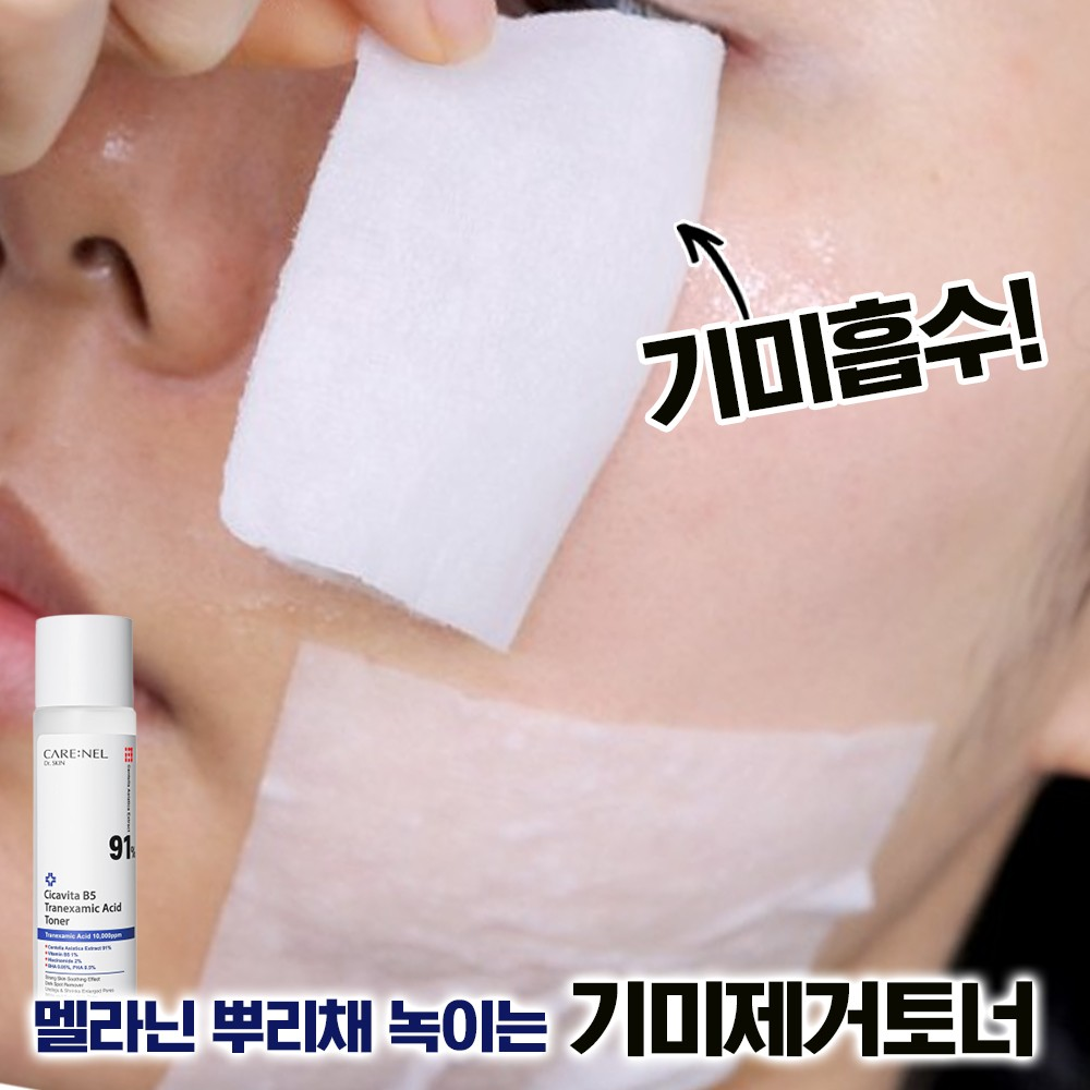 잡티스케일링 기미제거 91% 엑기스토너 155ml