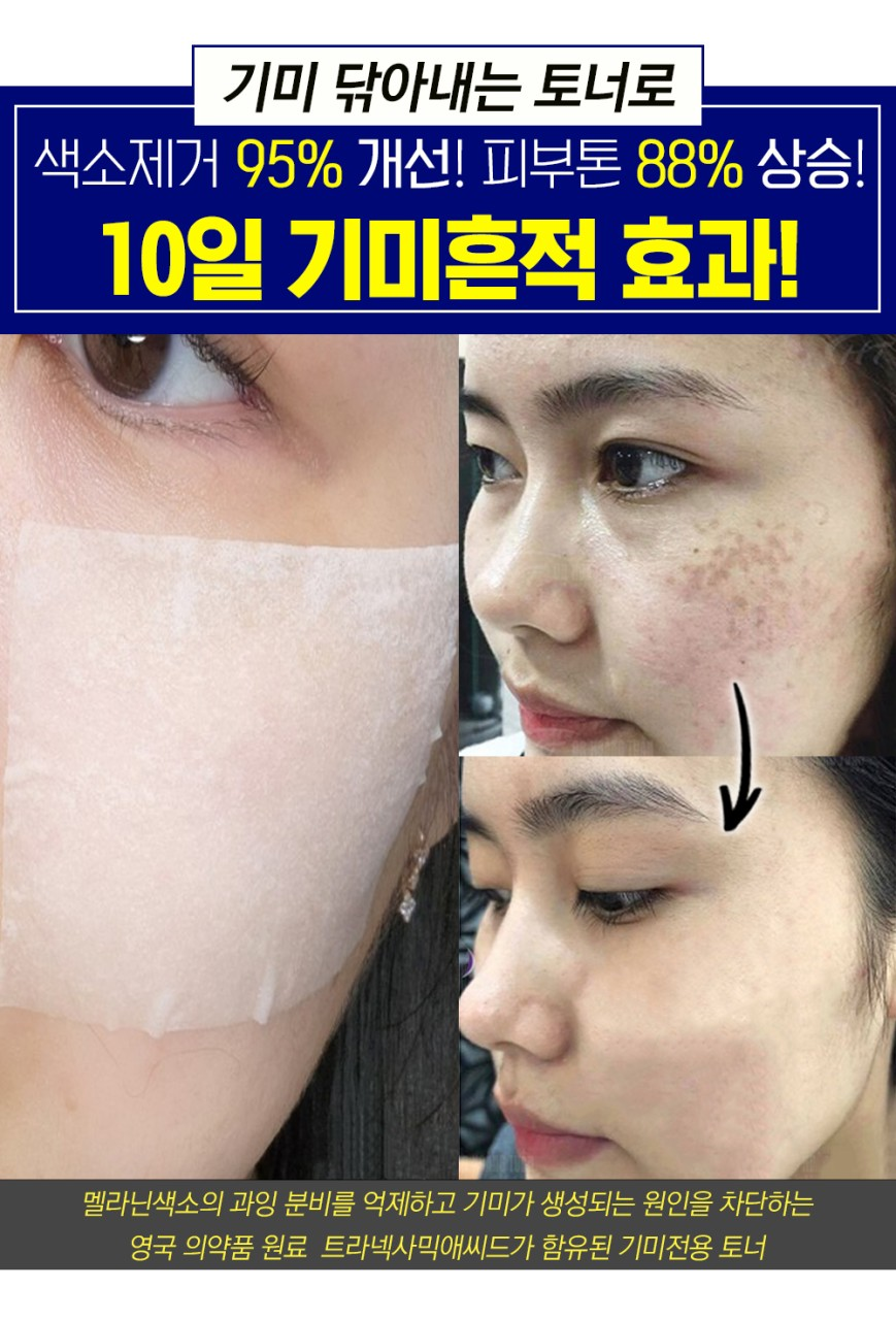 잡티스케일링 기미제거 91% 엑기스토너 155ml