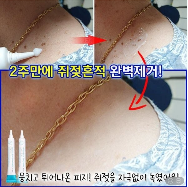 상품코드 : DD004 담다다담 쥐젖 크림 더마클리어스팟크림_20ml (카톤발주용)