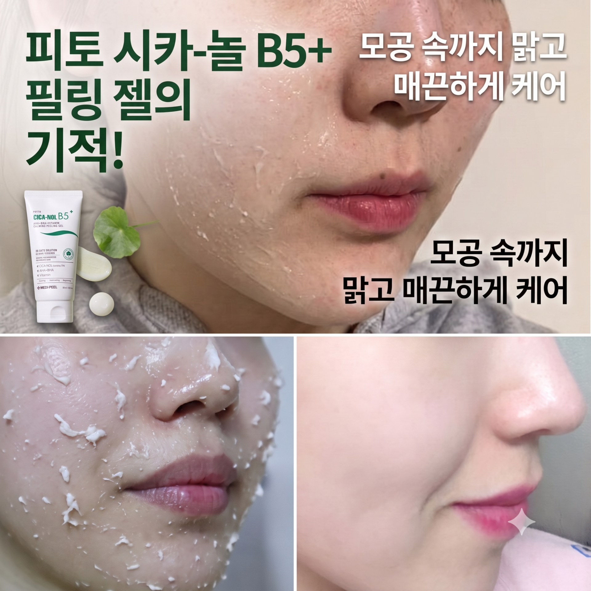 피부청소 시카놀 카밍 필링 젤