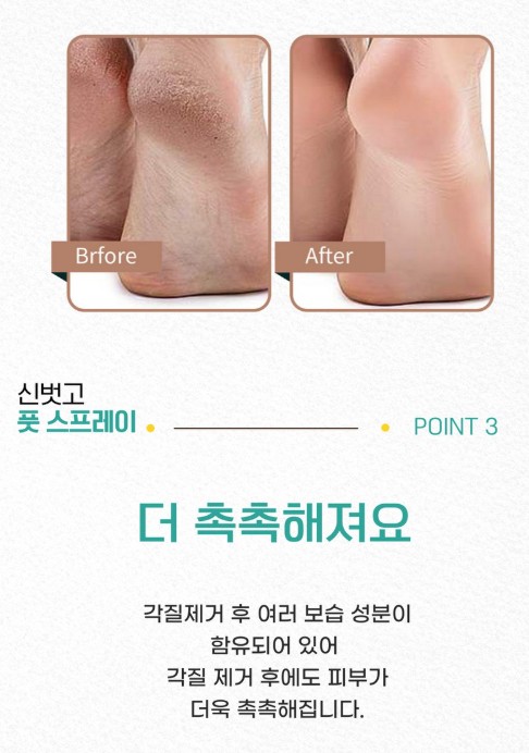 상품코드 : SBG02 신벗고 풋 스프레이 각질지우개 제거제 풋필링 100ml