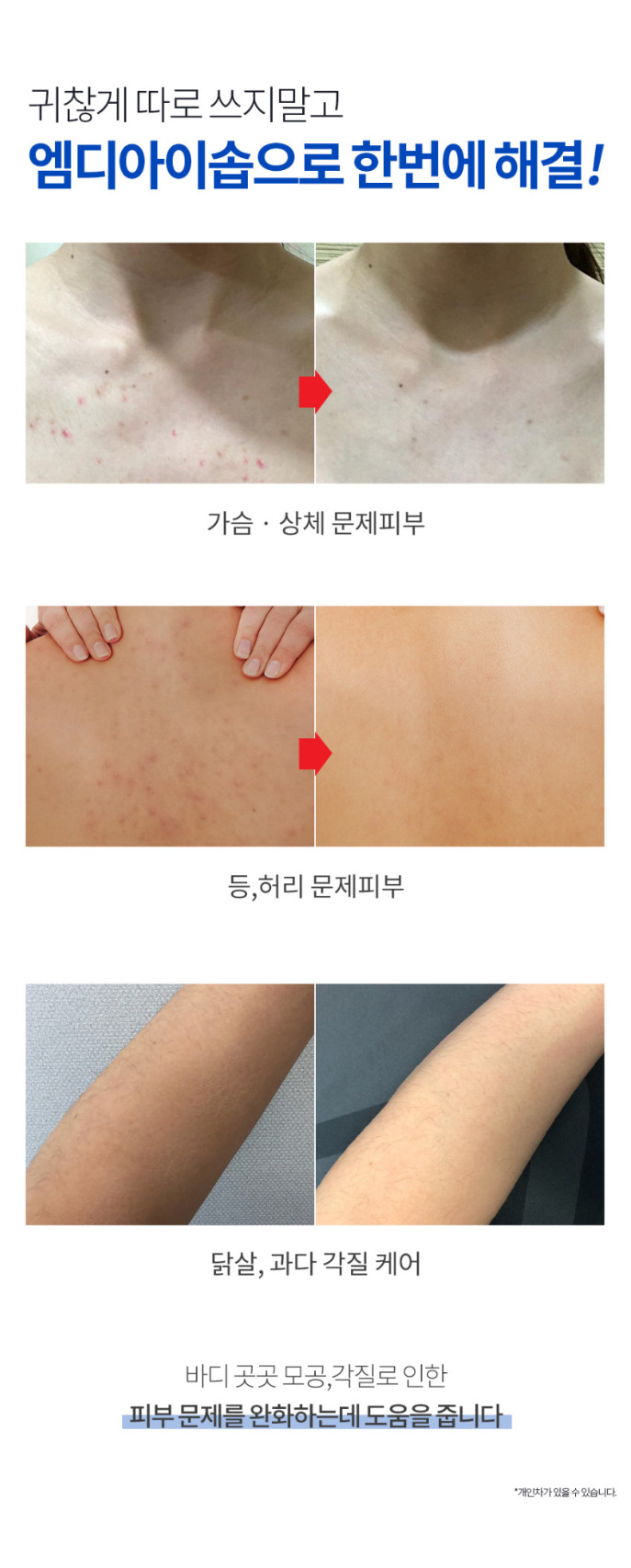 상품코드 : MM008 문제성피부 유황+BHA 함유 엠디아이솝 비누 100g