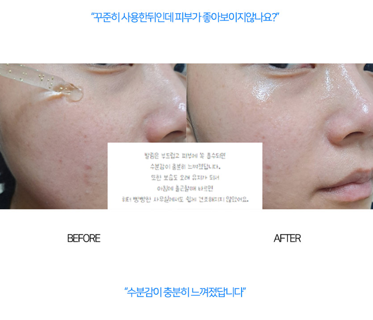 상품코드 : MB018 닥터썸 워터드롭+ 캡슐 앰플 100ml