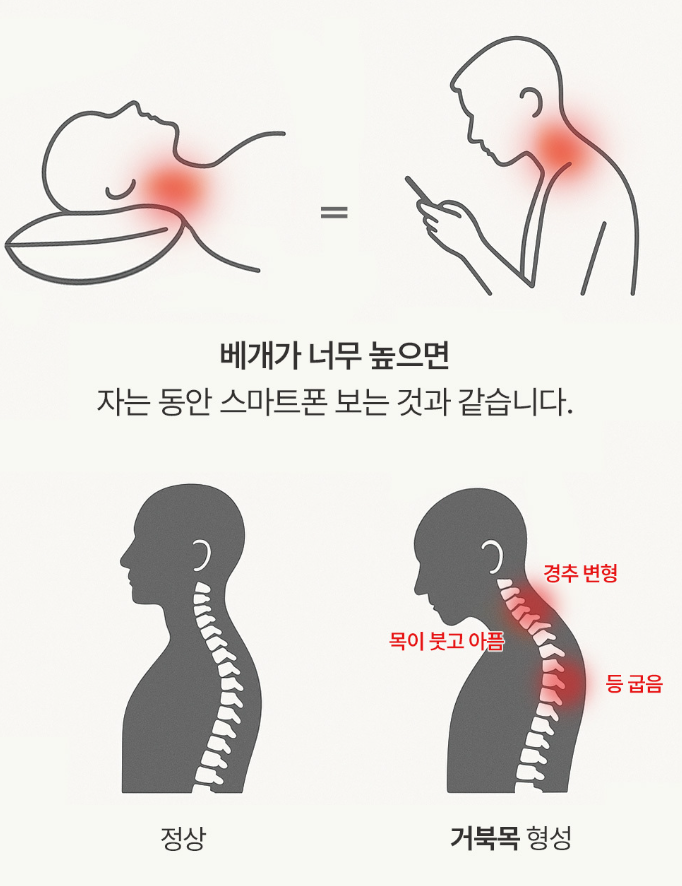 슬립온 인체공학 기능성 경추베개 1개입 (커버 증정)