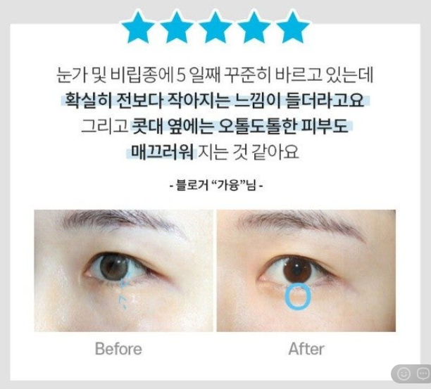 상품코드 : DD004 담다다담 쥐젖 크림 더마클리어스팟크림_20ml (카톤발주용)