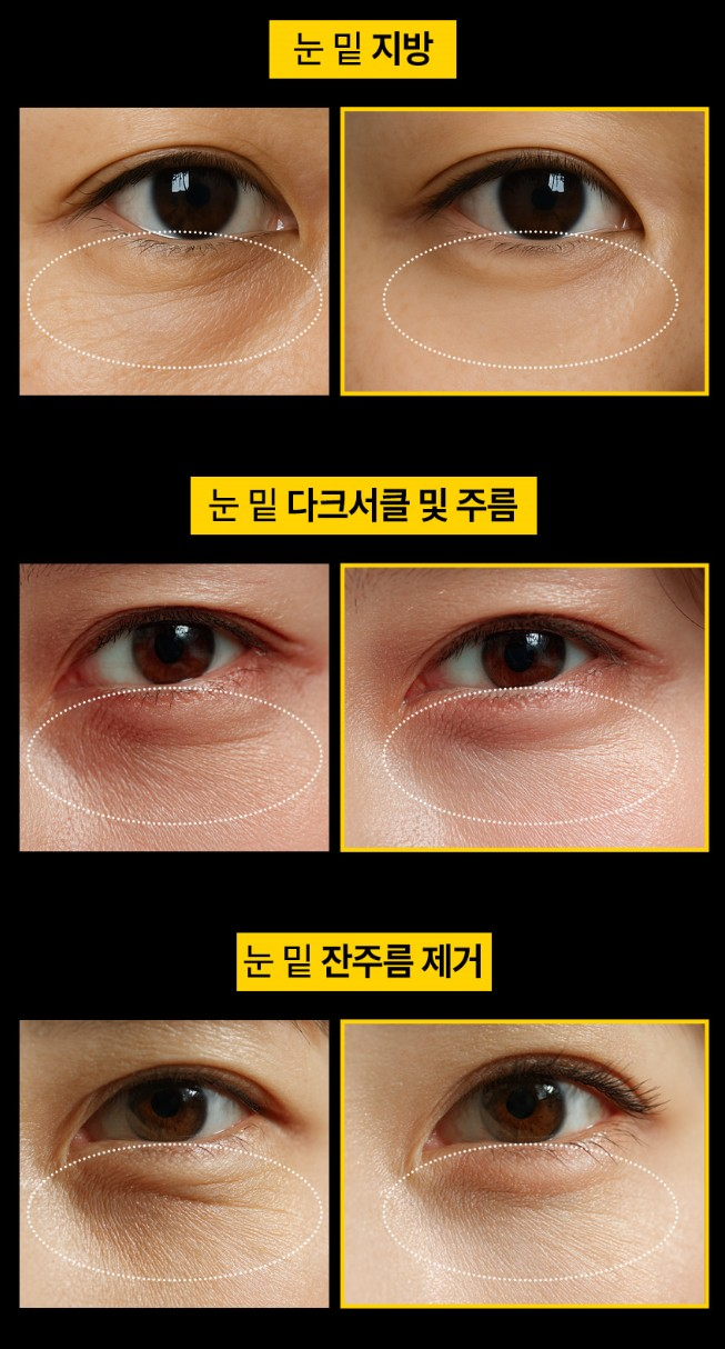 (노화지연) 블랙골드 아이크림 40g