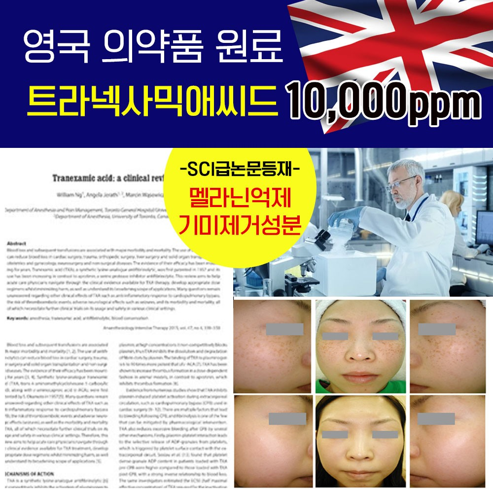 잡티스케일링 기미제거 91% 엑기스토너 155ml