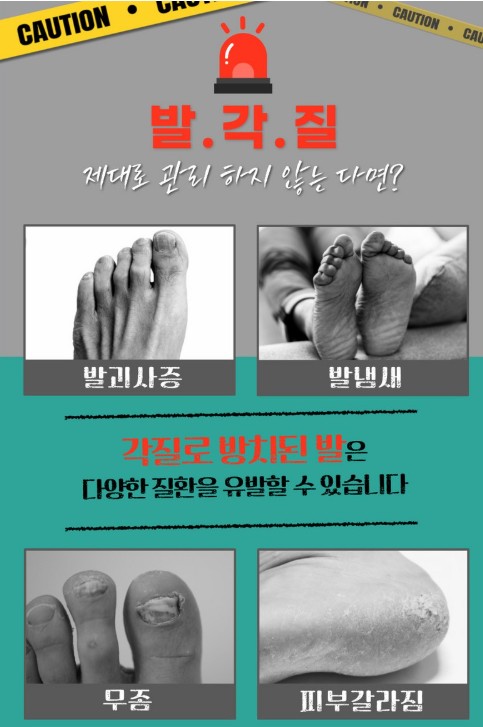 상품코드 : SBG02 신벗고 풋 스프레이 각질지우개 제거제 풋필링 100ml