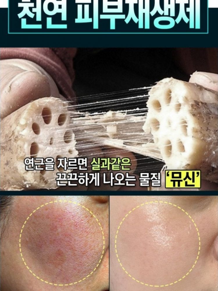 연근 시카플러스 리뉴 크림 50ml