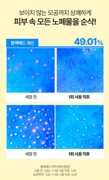 레니스 아이스 블루 빙하수 클렌징 오일 200m