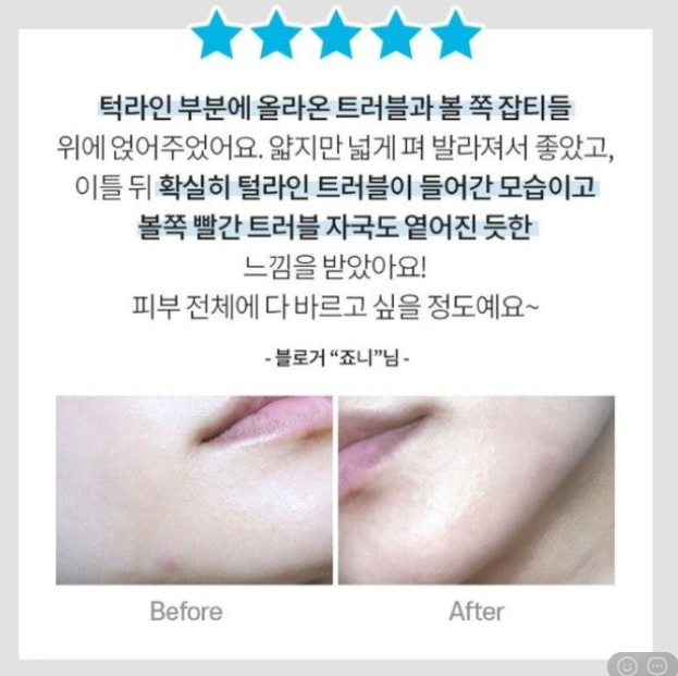 상품코드 : DD004 담다다담 쥐젖 크림 더마클리어스팟크림_20ml (카톤발주용)