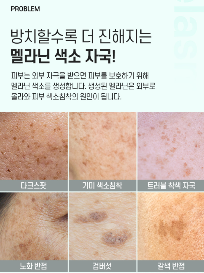 까레넬 기미잡티 안색개선 안티멜라즈마 세럼 30ml