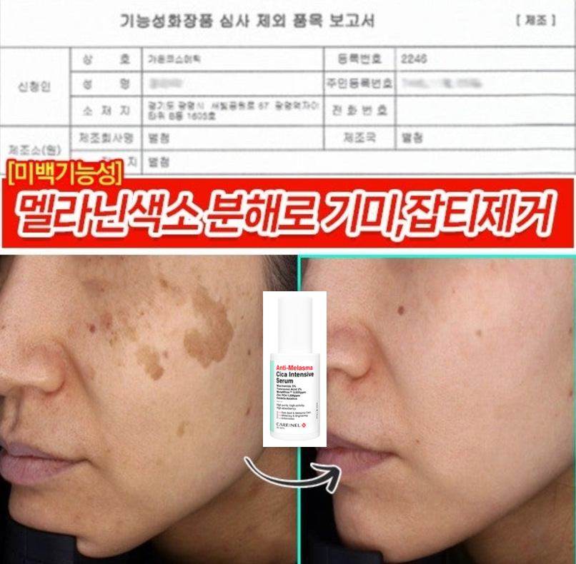 까레넬 기미잡티 안색개선 안티멜라즈마 세럼 30ml
