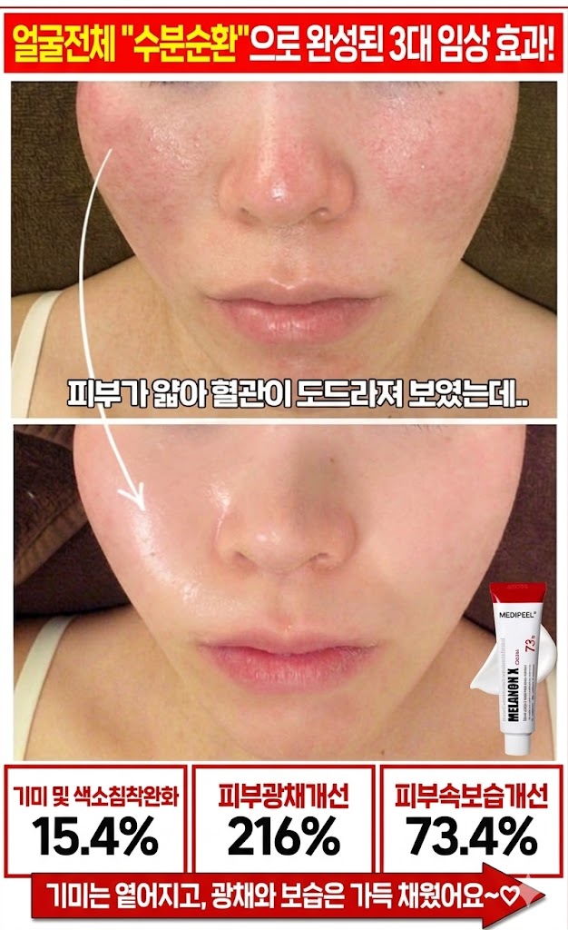 메디필 기미 멜라논엑스크림