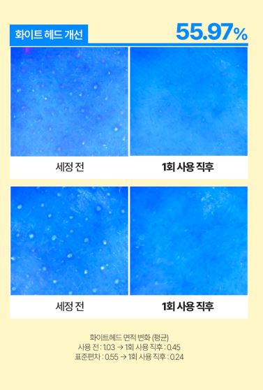 레니스 아이스 블루 빙하수 클렌징 오일 200m
