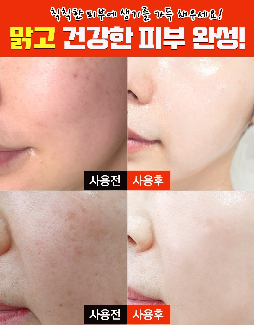 기미밸런스 기미잡티 비타민C크림 40ml