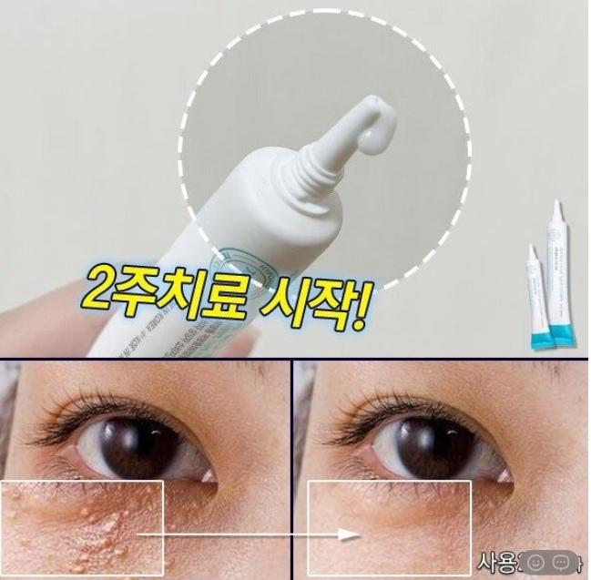 상품코드 : DD004 담다다담 쥐젖 크림 더마클리어스팟크림_20ml (카톤발주용)