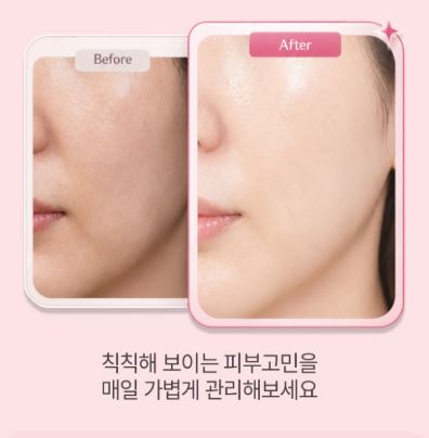 라이프턴 글루타치온 퓨어 화이트닝 츄어블 무설탕 캔디 샤인머스캣맛 20정