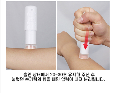 상품코드 : ATB001 국내특허 안티버그 ATB 모기케어 휴대용 필수템