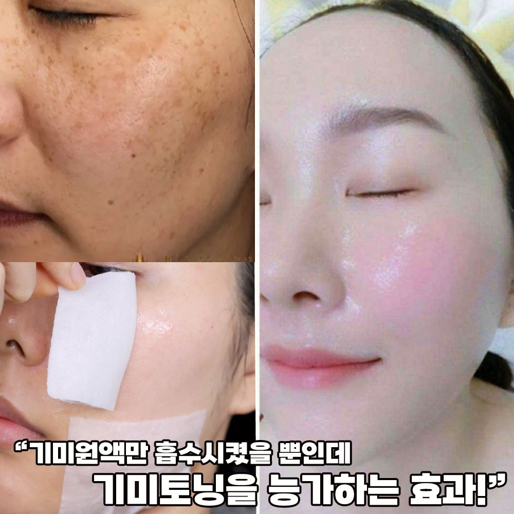 잡티스케일링 기미제거 91% 엑기스토너 155ml