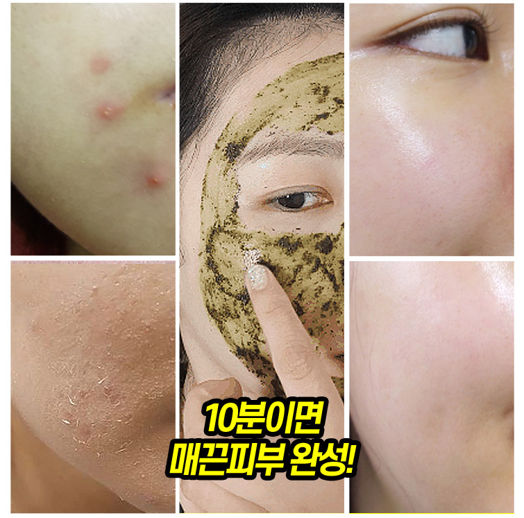 메디필 알고톡스 필오프마스크팩