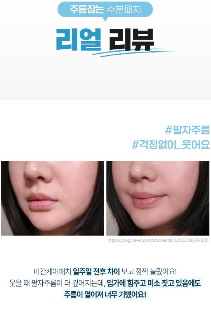 상품코드 : K0386 [라보타치] 미간 팔자 케어 패치 12매 (낱개발주용)