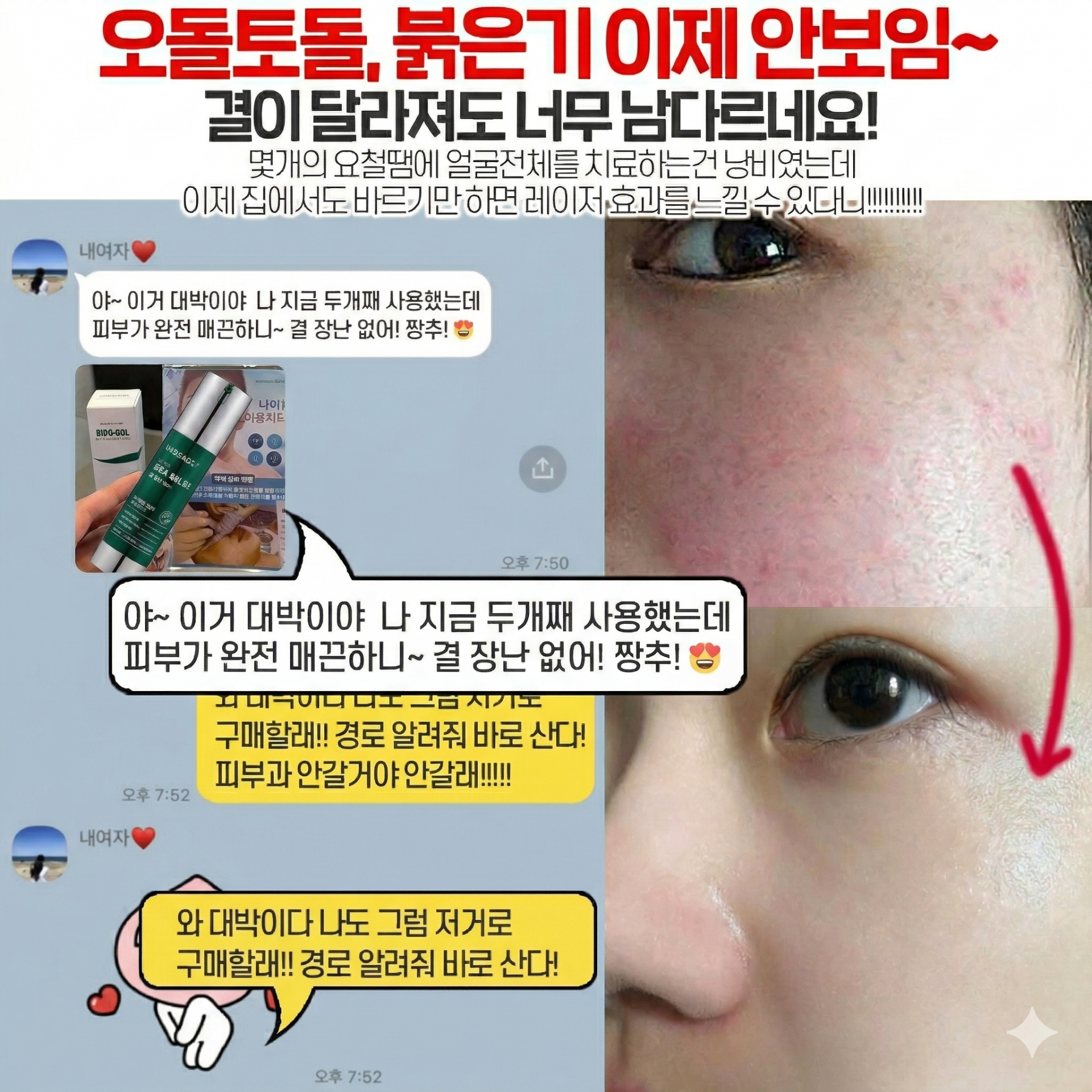 메디필 피토시카재생 비립종 3000샷