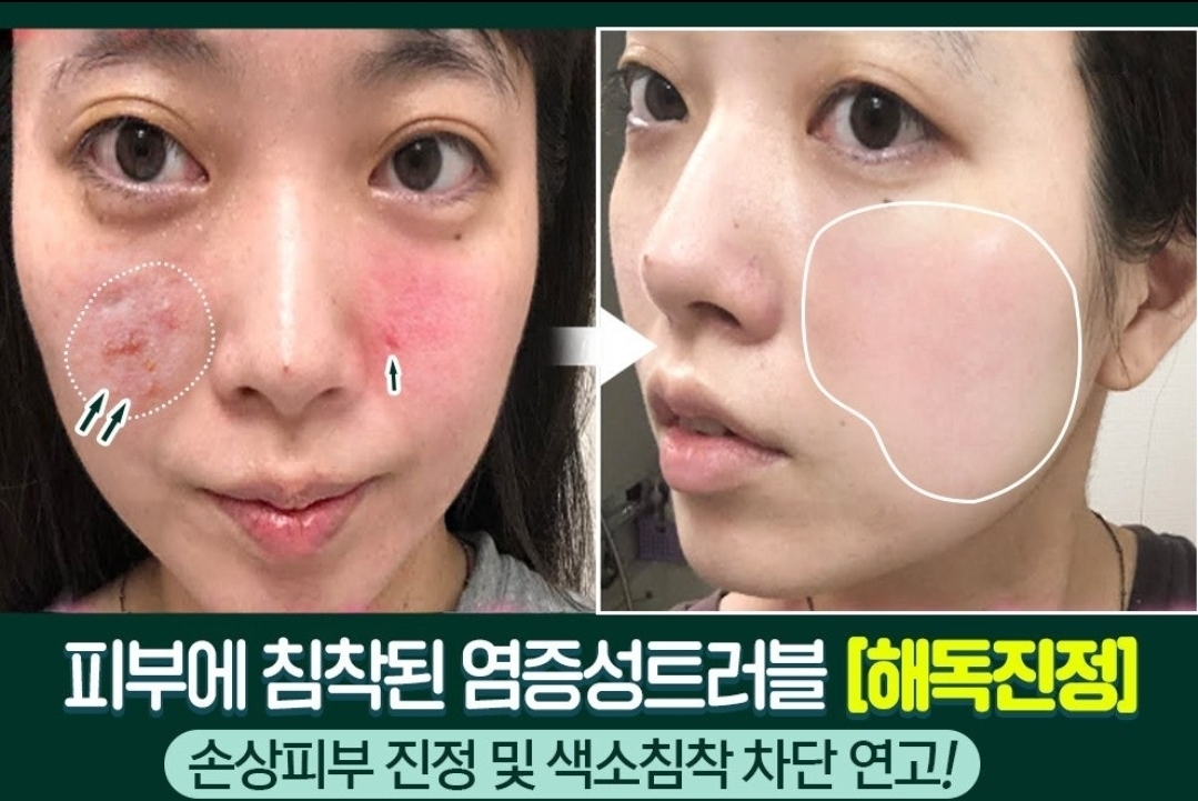 까레넬 새살솔솔 염증시카크림 용량업 40ml
