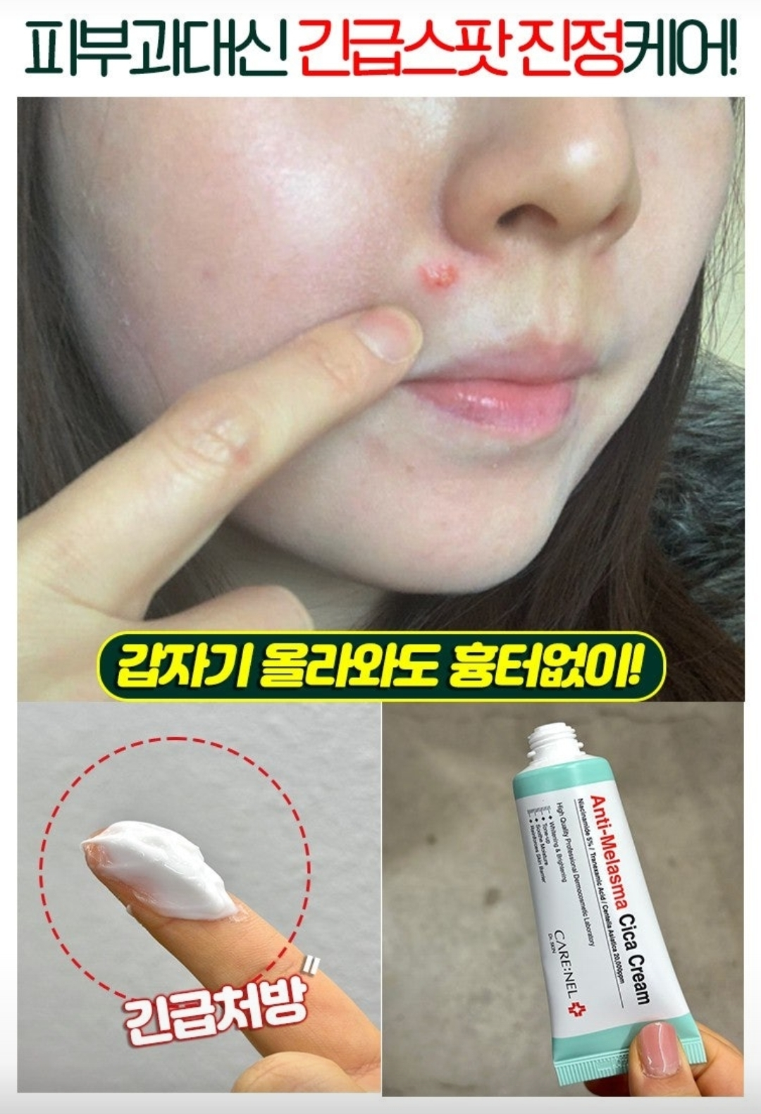 까레넬 새살솔솔 염증시카크림 용량업 40ml