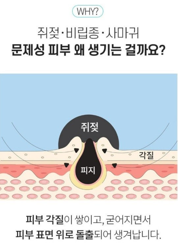 상품코드 : DD004 담다다담 쥐젖 크림 더마클리어스팟크림_20ml (카톤발주용)
