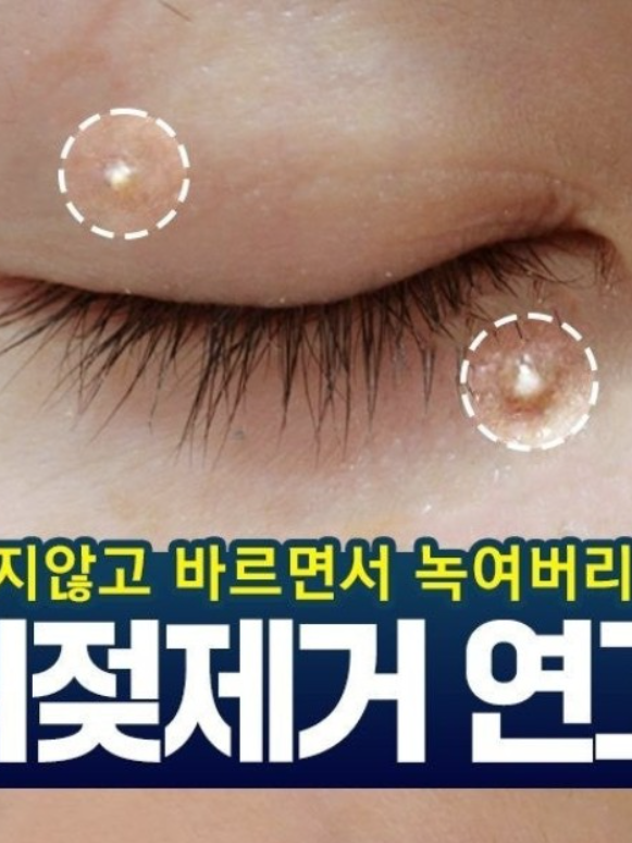 담다다담 쥐젖 크림 더마클리어스팟크림_20ml (낱개발주용)