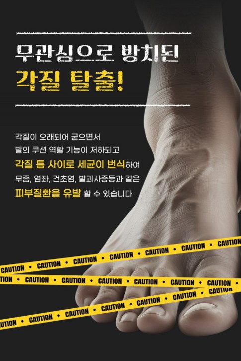 상품코드 : SBG02 신벗고 풋 스프레이 각질지우개 제거제 풋필링 100ml