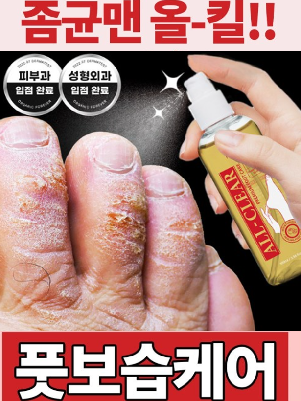 좀균맨 올킬! 무좀 발냄새각질 풋미스트 100ml