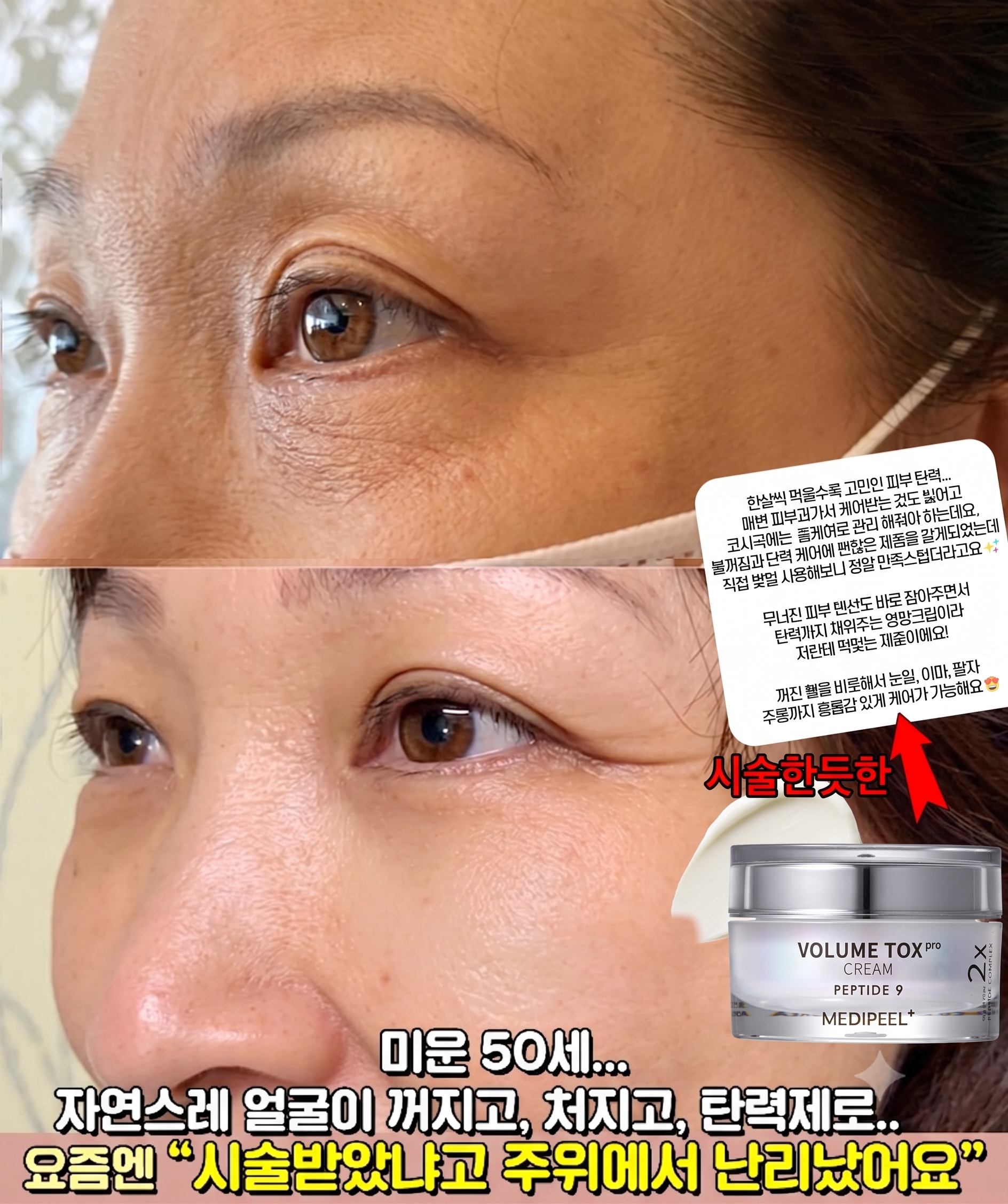 메디필 펩타이드9볼륨톡스크림프로 50ml