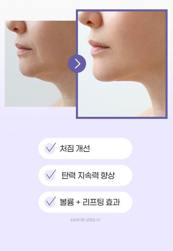 쁘띠 엔엠엔C 이너뷰티 NMN