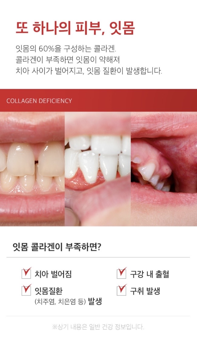 메디필덴틸잇몸치약(100g)