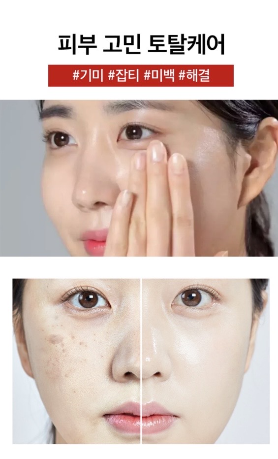 메디필 기미 멜라논엑스크림