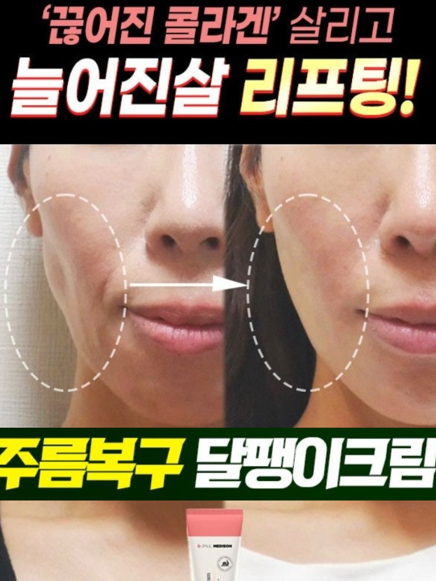폴메디슨 올인원 달팽이 크림 4종 100ml 택1