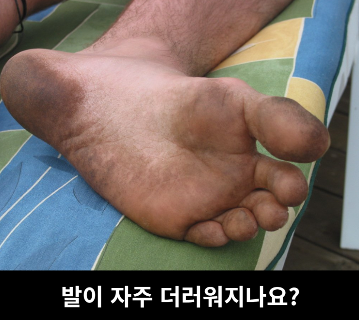 상품코드 : H3922 [아케이] 리빙 안티폴루 풋브러쉬