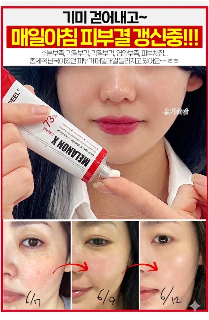 메디필 기미 멜라논엑스크림