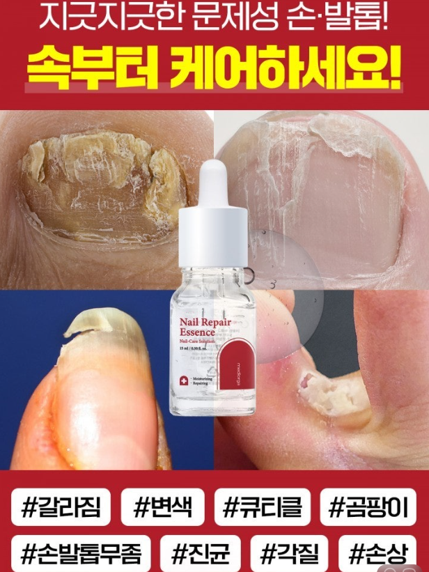 싱품코드 : MO002 무좀싹 문제성 손발톱 1초 리페어 에센스 15ml
