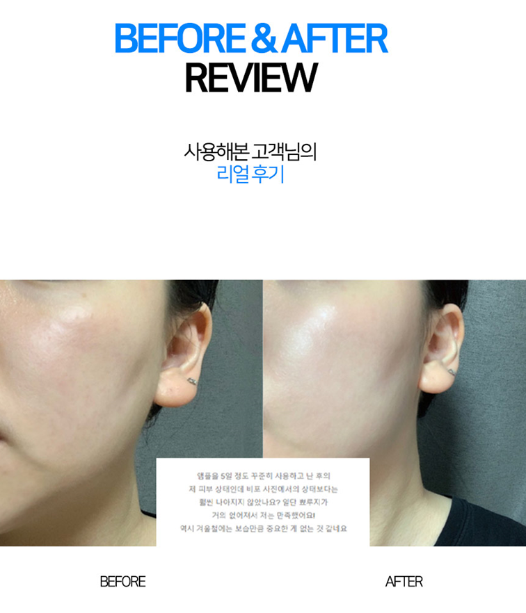 상품코드 : MB018 닥터썸 워터드롭+ 캡슐 앰플 100ml