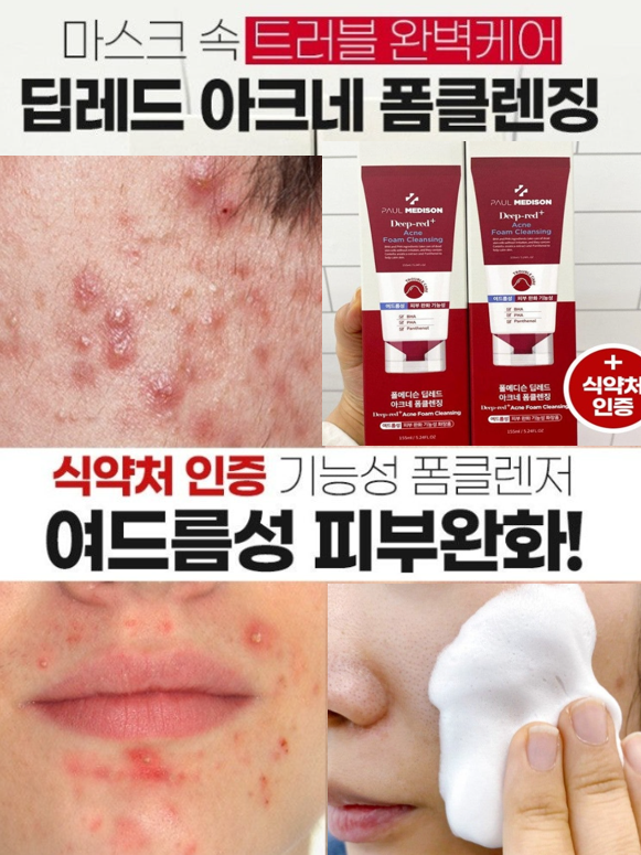 딥레드 아크네 폼클렌징 155ml
