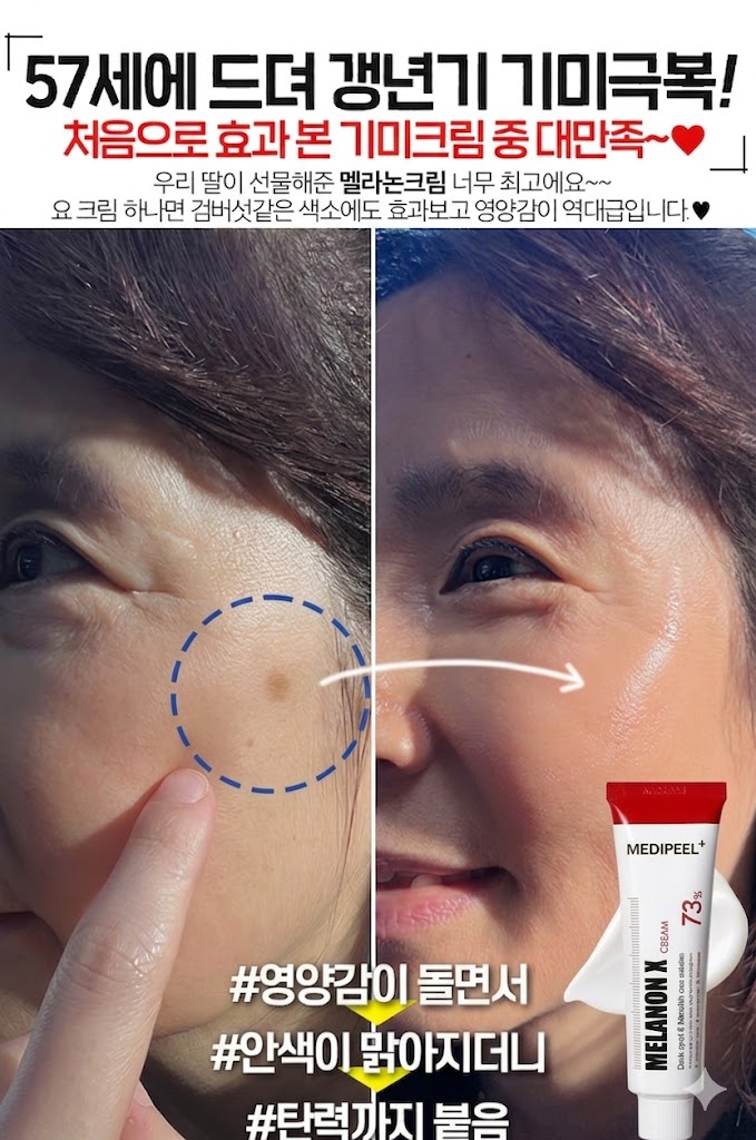 메디필 기미 멜라논엑스크림