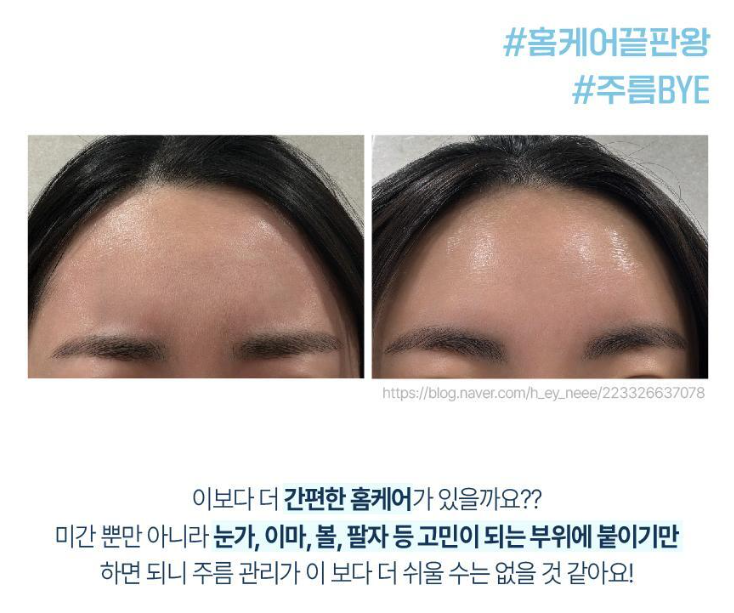 상품코드 : K0386 [라보타치] 미간 팔자 케어 패치 12매 (낱개발주용)