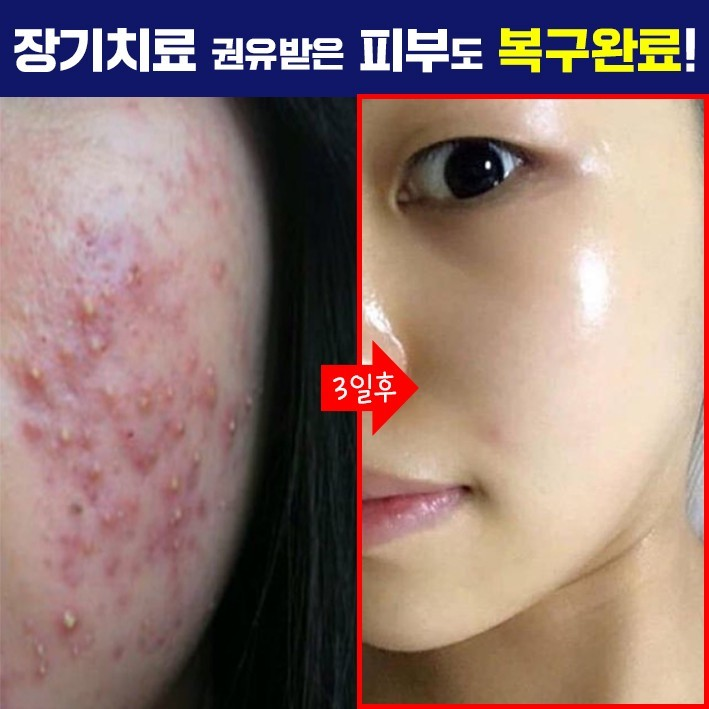 까레넬 히아루 비타5 시카세럼 30ml