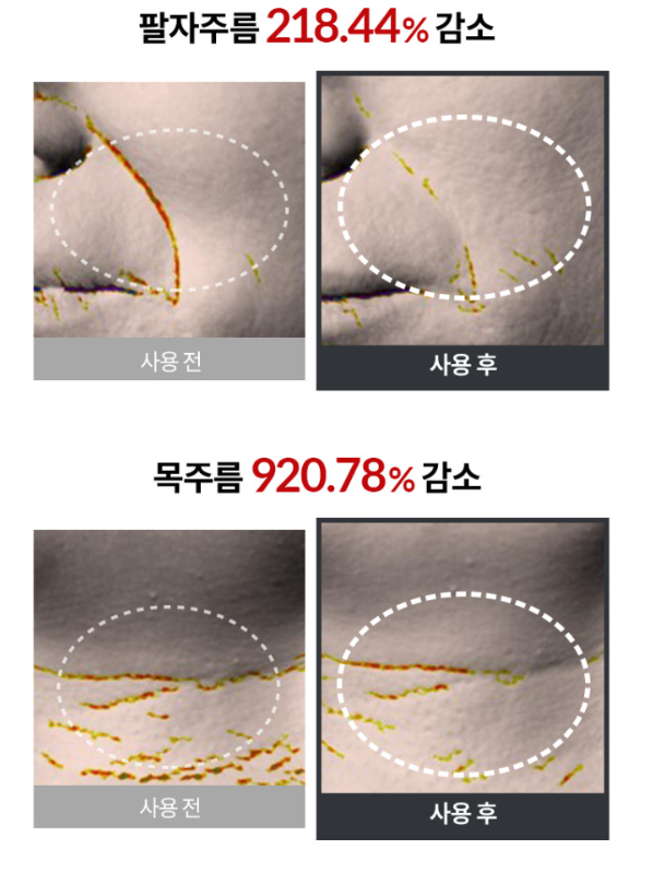 셀비엘 링클레볼루션 필톡스 주름지우개 10ml